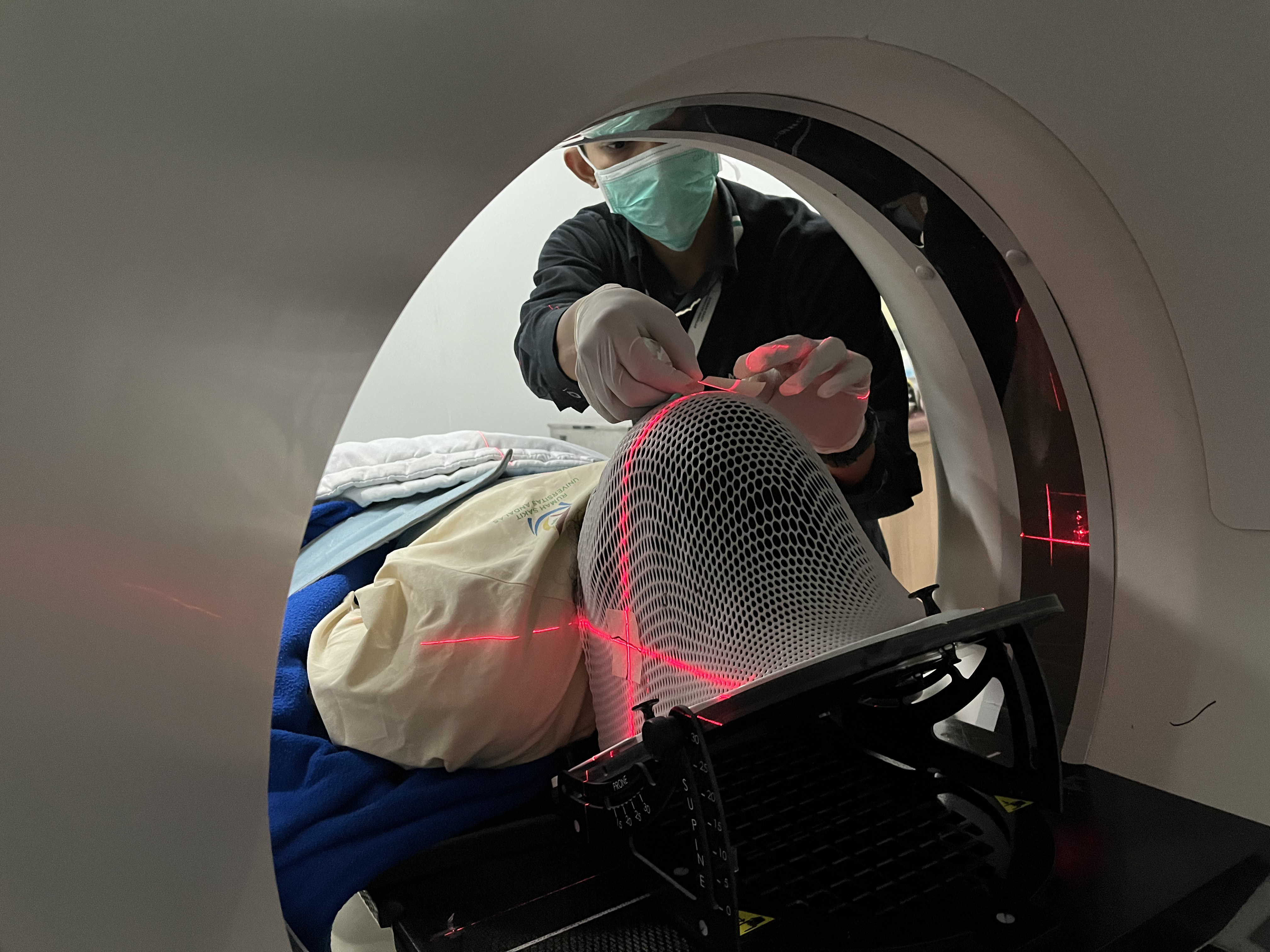Perangkat CT Simulator untuk persiapan radioterapi